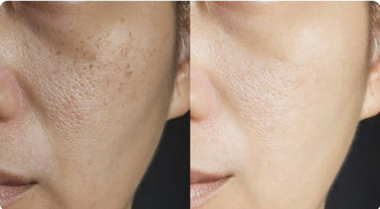 Mythes sur les soins anti-âge auxquels vous devriez cesser de croire